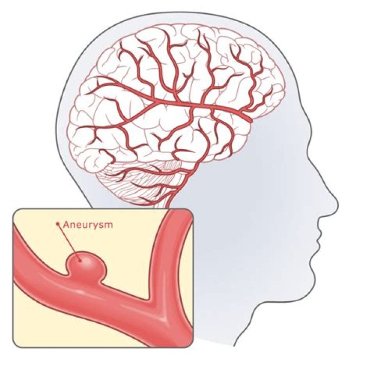 Rob Luna Wikipedia | How Old Was He | Did He Die Of Brain Aneurysm